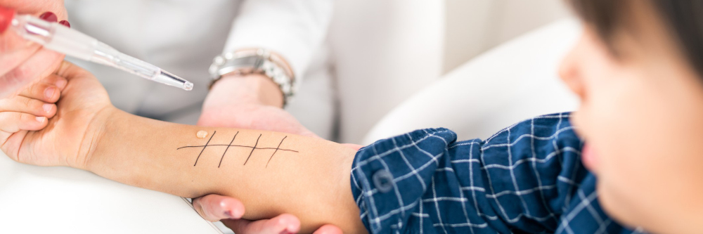 Allergien bei Kindern — Was Eltern beachten sollten und wie sie helfen können