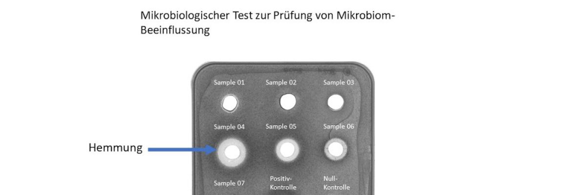  Tests haben gezeigt, ob Hautcremes gesunde Bakterien in ihrem Umfeld stärken oder hemmen. Je stärker die Hemmung, um so ausgeprägter der weiße Kreis um die Creme-Probe ©BELANO medical