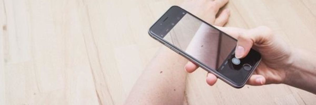Die eigene Haut mit dem Handy ablichten ©OnlineDoctor